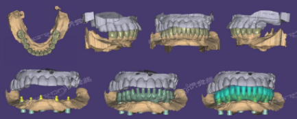 96a96e35-3055-492b-b909-23abc8ba7dc4.png